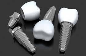 Closeup of dental implants in Hamden on dark background