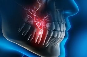 Digital image of a tooth and pain occurring in the inner layer, the pulp