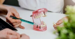 Dentist using model to explain dental implants